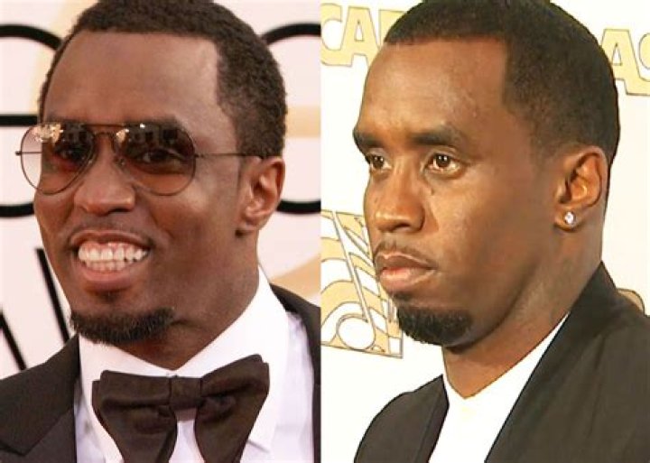 P Diddy Hairline: The Journey of a Style Icon